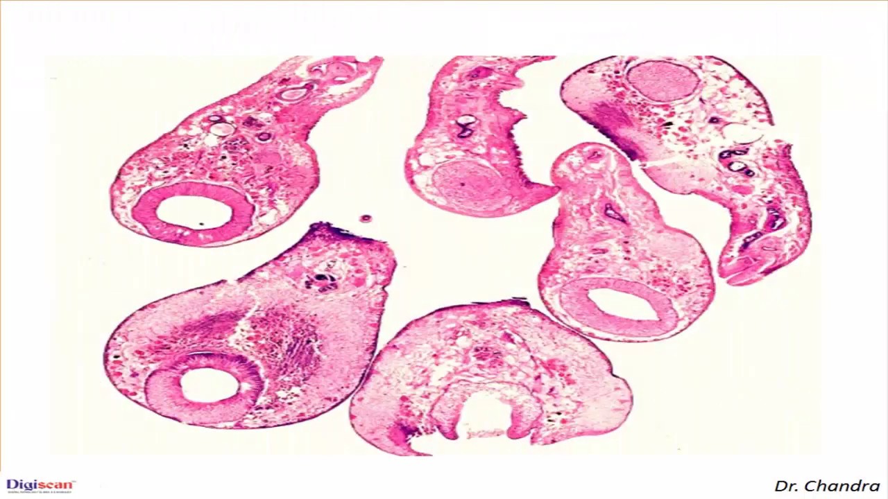 Parasites-Gastrodiscoides Hominis - Digipath Tutorials-by Dr. M. Chandra
