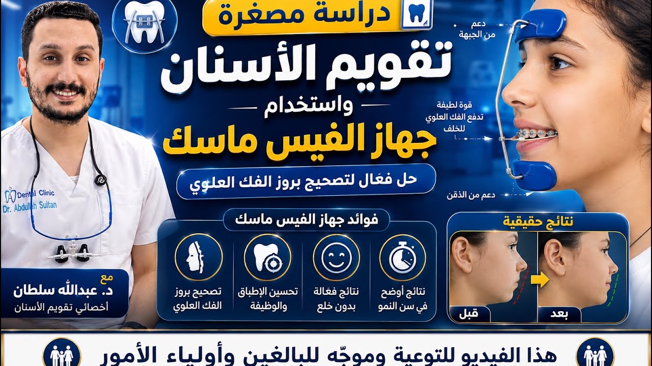 لؤي البطل ركب جهاز الفيس ماسك لتقويم الاسنان ||Class 3 face mask orthodontic #dr_abdullah_sultan