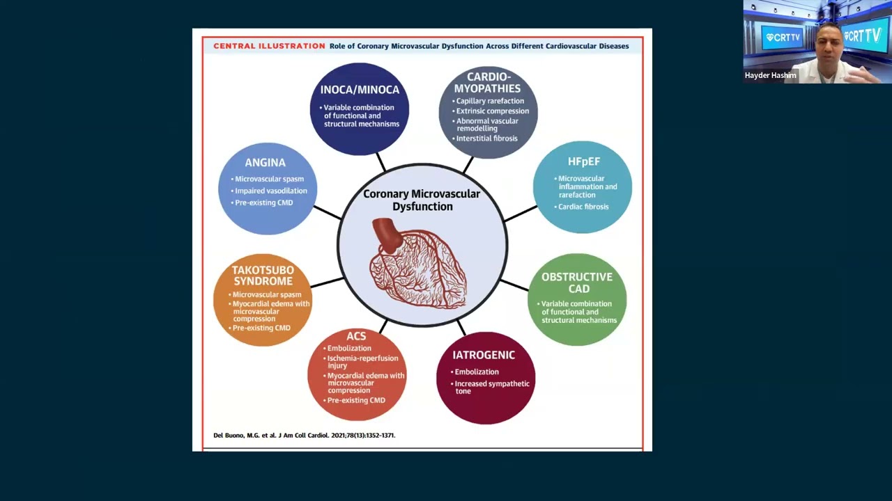 DCB Academy | Special Guest Lecture, Rethinking Chest Pain Without Obstructive CAD
