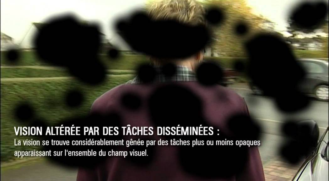 Malvoyance - version courte 2011