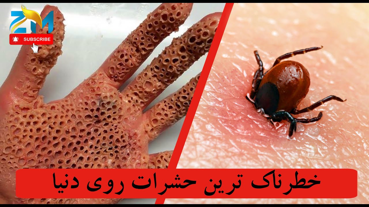 خطرناک ترین حشرات روی دنیا | The most dangerous insects in the world
