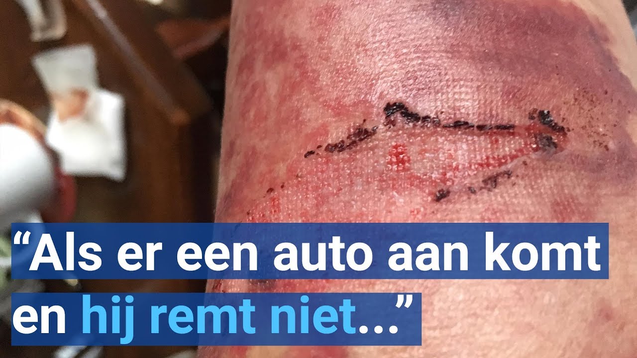 Scootmobiel slaat op hol: bestuurder raakt gewond