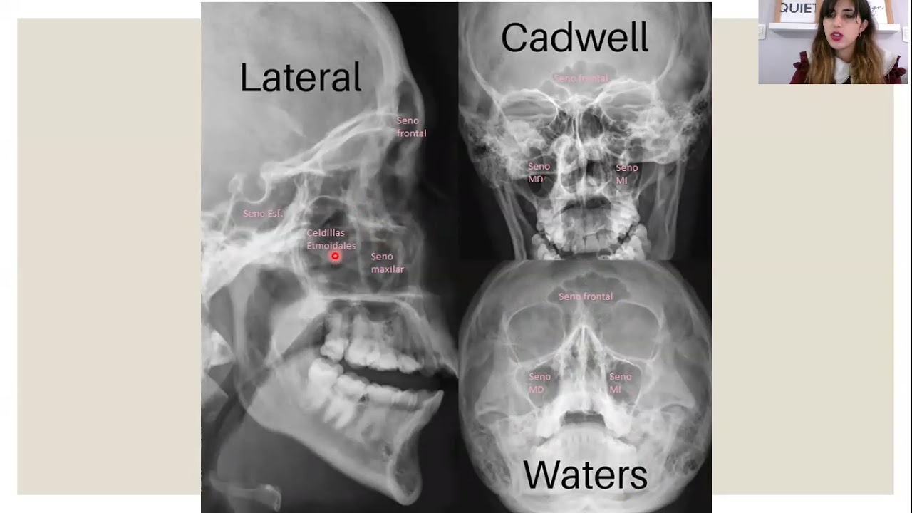 Anatomia por Imágenes - Respiratorio 2021