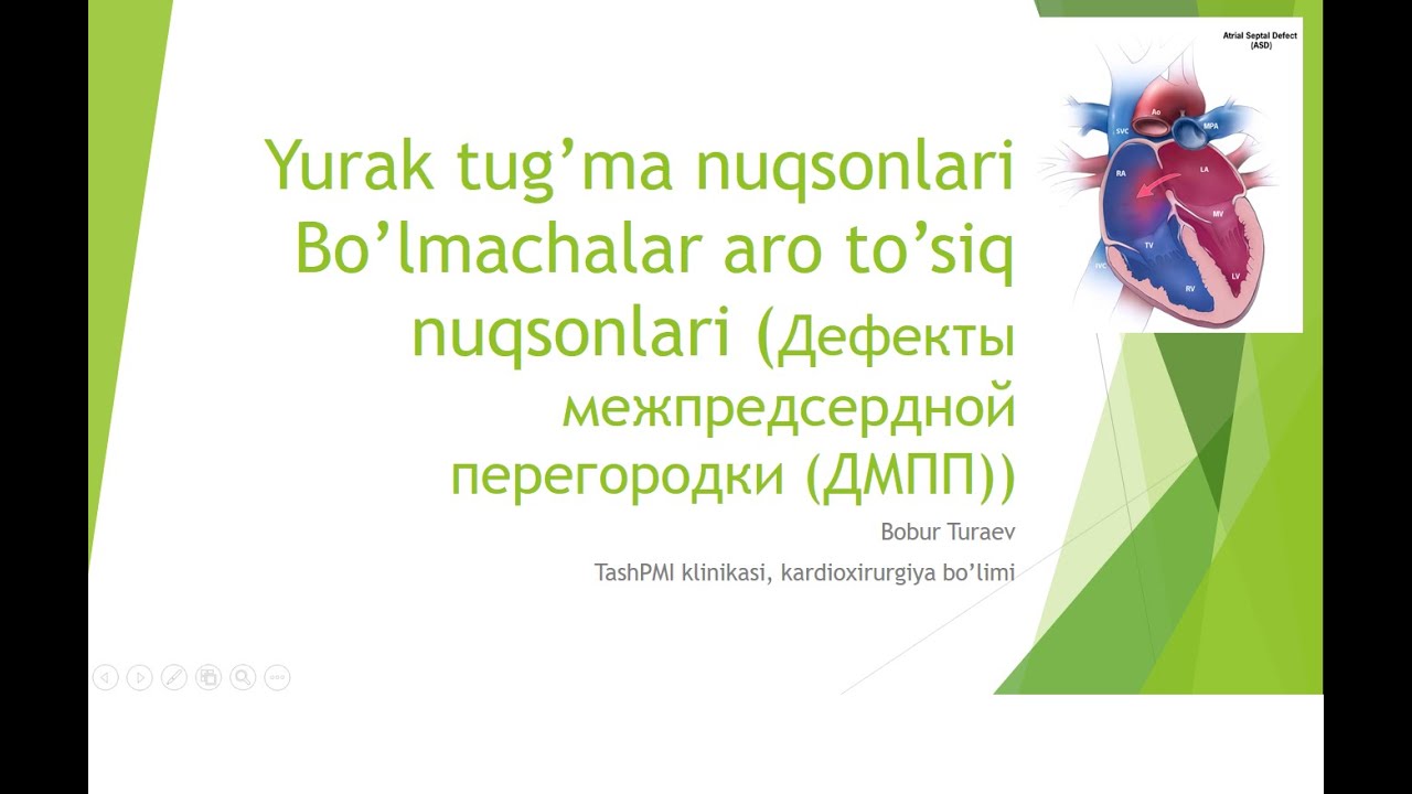 Bo’lmachalar aro to’siq nuqsonlari (BATN) - Дефекты межпредсердной перегородки (ДМПП)