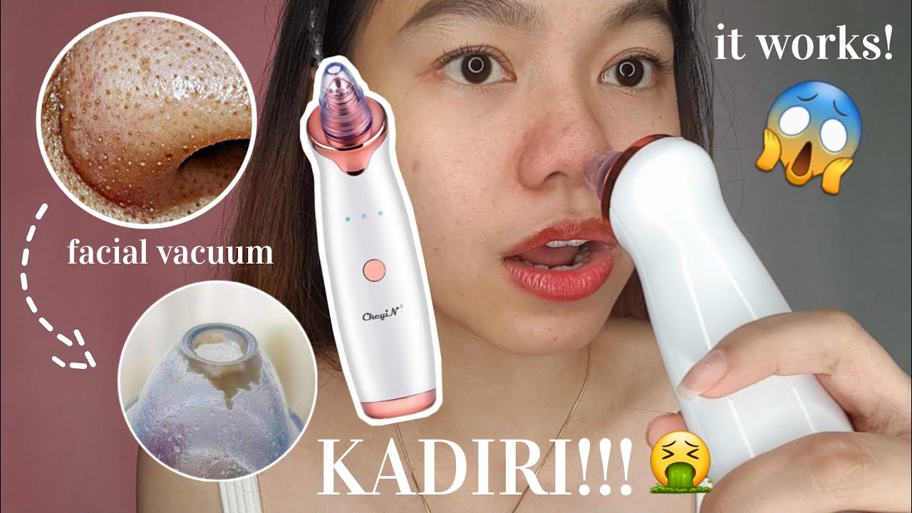 BEST PORE VACUUM CLEANER + HOW TO USE FACIAL VACUUM (Success!) | Hello Katy