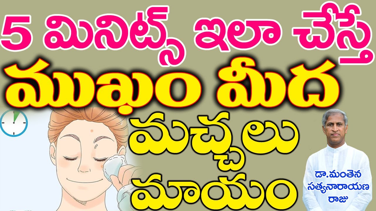 ఇలా చేస్తే ముడతలు, మొటిమలు, మచ్చలు మాయం I Pimples Removal on Face | Dr Manthena Satyanarayana Raju
