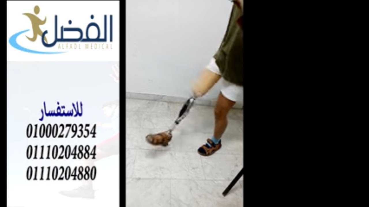 شاهد افضل سوكت للطرف الصناعى  الذكي الالمانى - يمكنك الان لعب الكرة بحرية تامة - الفضل ميديكال مصر