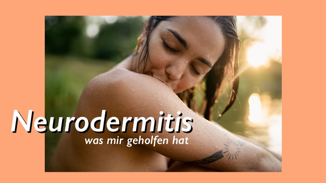 Neurodermitis - Was mir wirklich geholfen hat