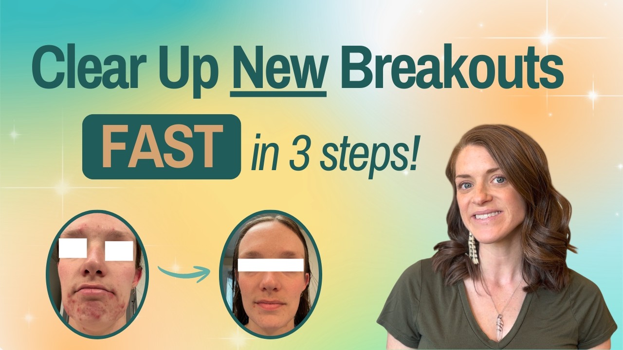 Clear Up New Breakouts in 48 Hours with 3 Simple Steps
