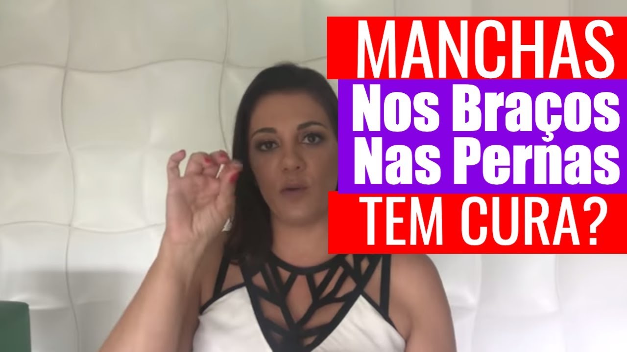 TRATAMENTO E CURA DAS MANCHAS BRANCAS NOS BRAÇOS E NAS PERNAS, EXISTE?
