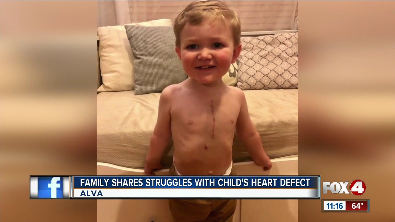 Family shares struggles with child's heart defect