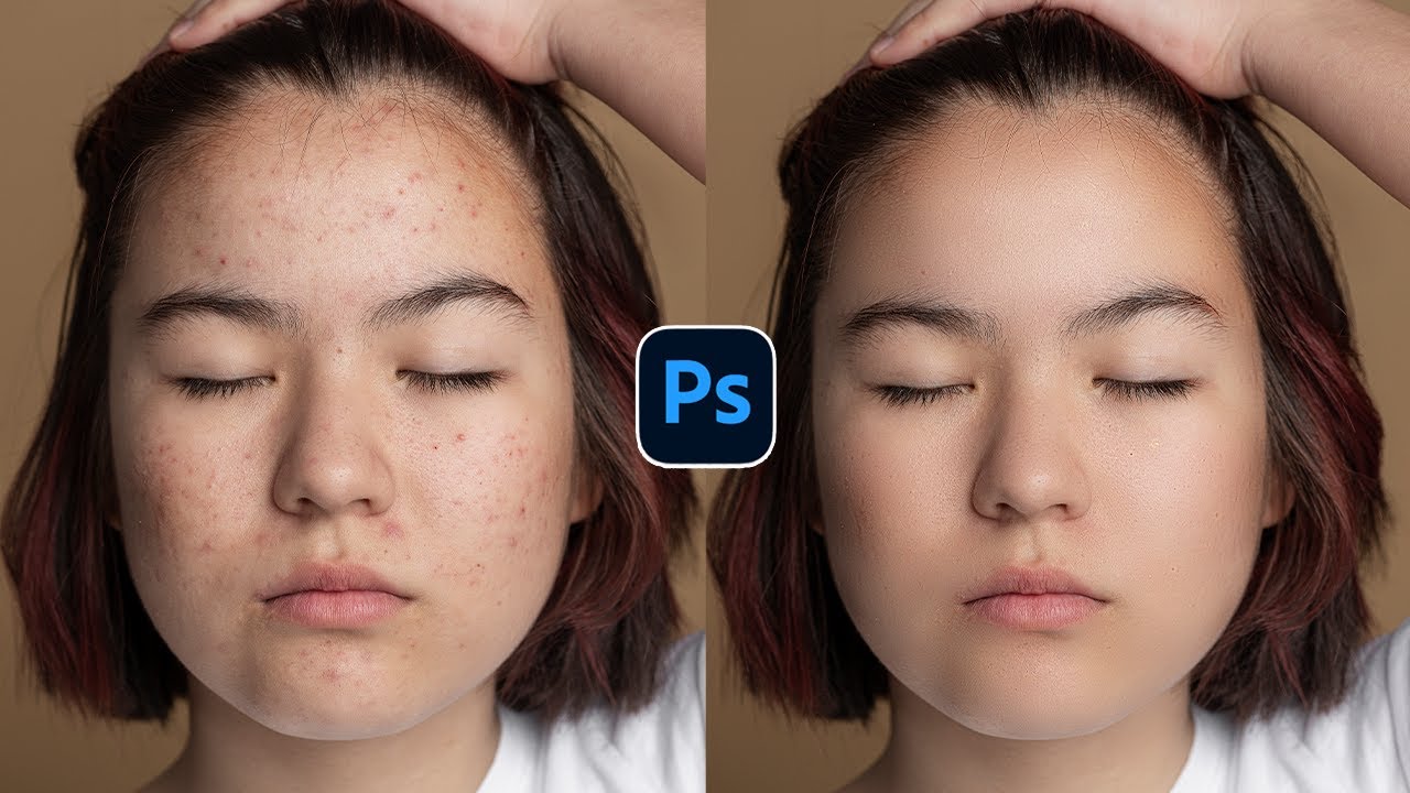 How to Retouch Skin and Remove Blemishes in Photoshop | Skin Retouching