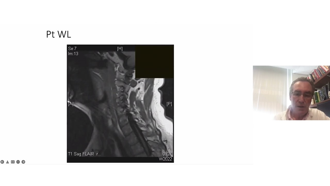 112  Evaluation of Unexplained Dyspnea  HarvardUpdate Medstudylab.com