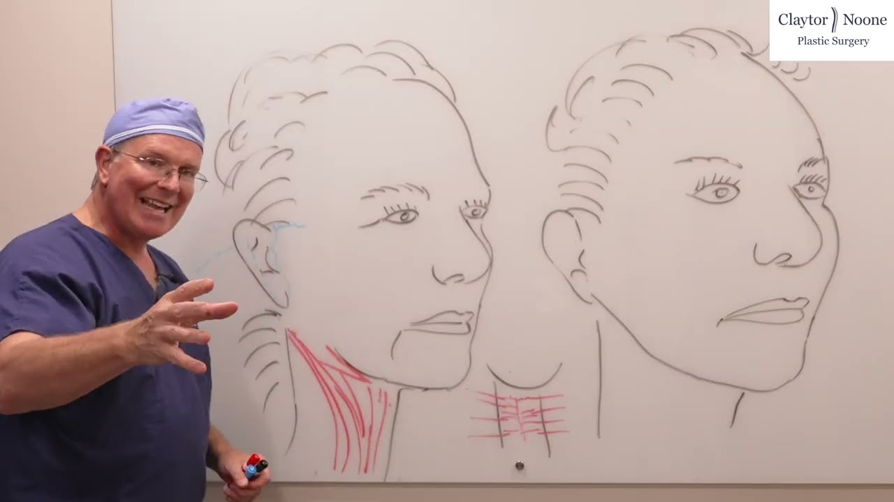 Neck Lift vs Facelift: What’s the difference? | Pick the Right Procedure For You - Dr. Claytor