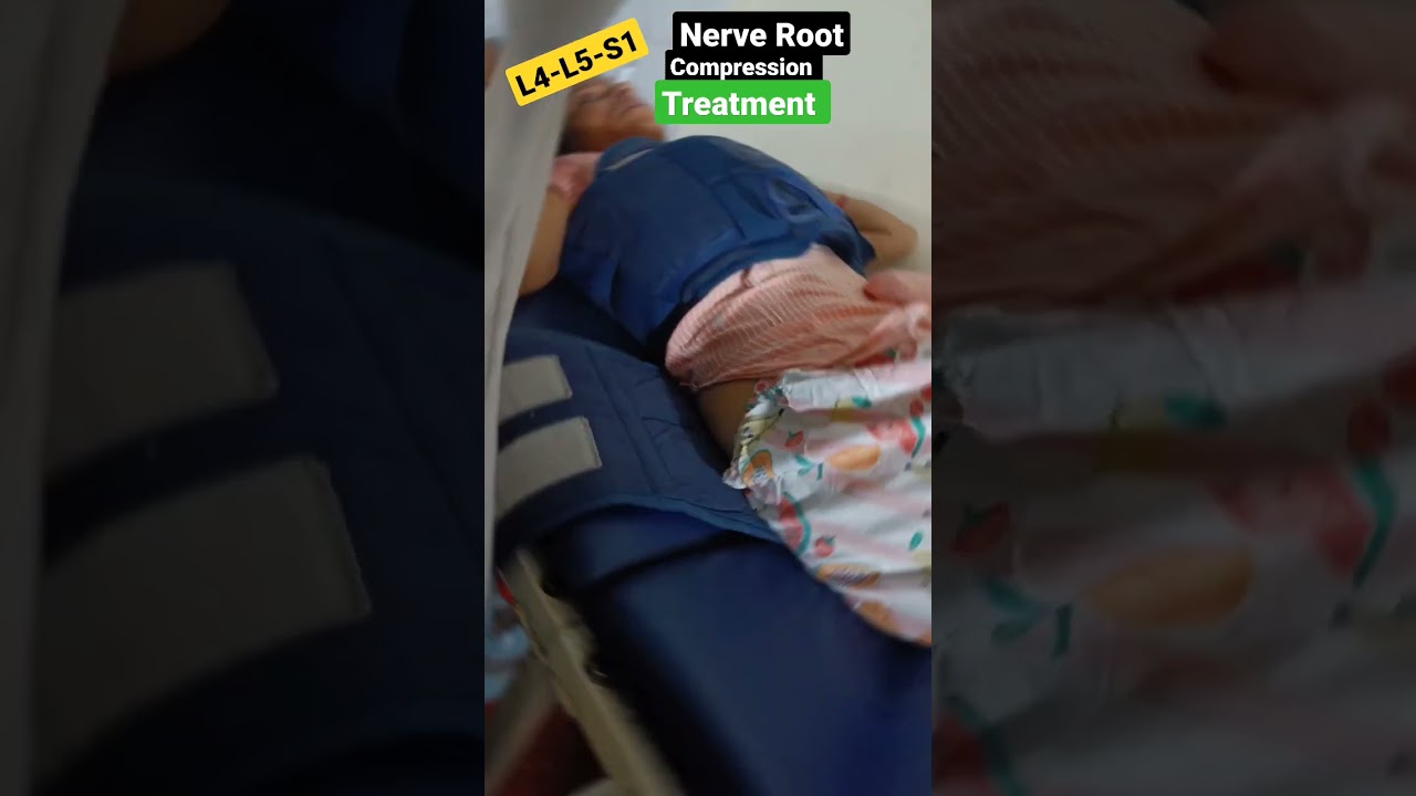 L4-L5-S1 Nerve Root Compression Treatment #shorts #SpinalTraction