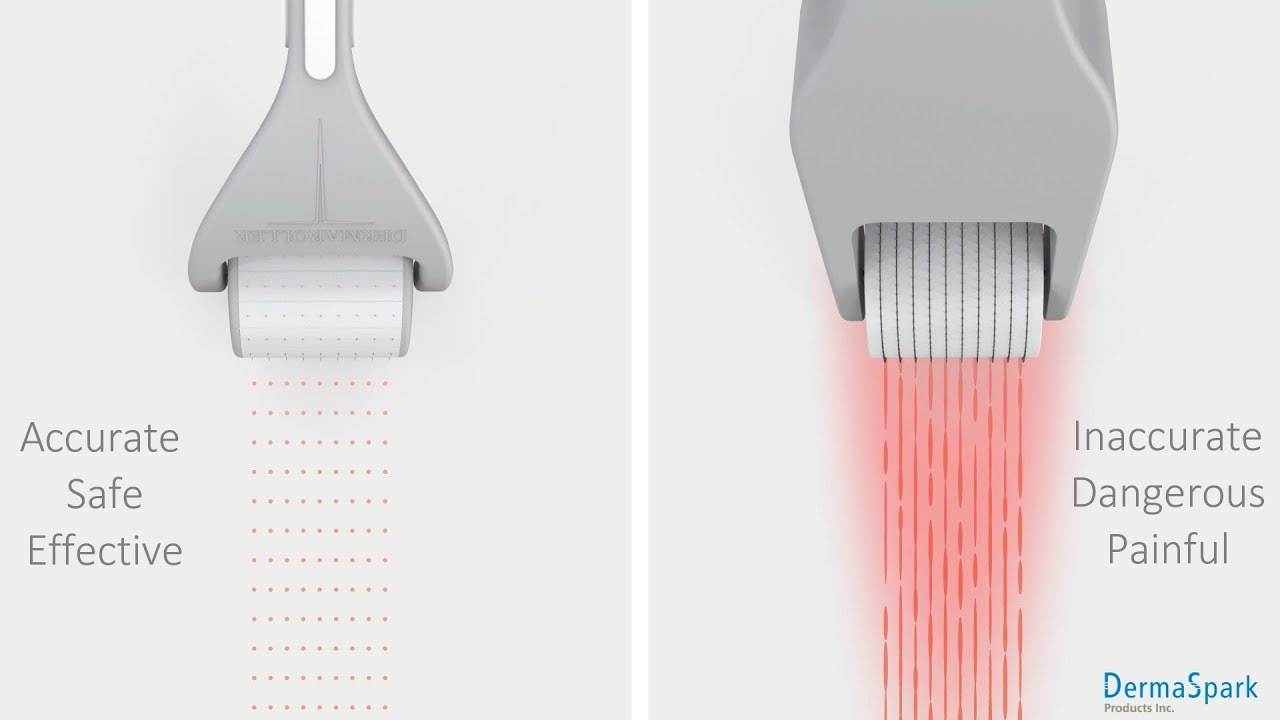Dermaroller® Home Care roller VS. other rollers