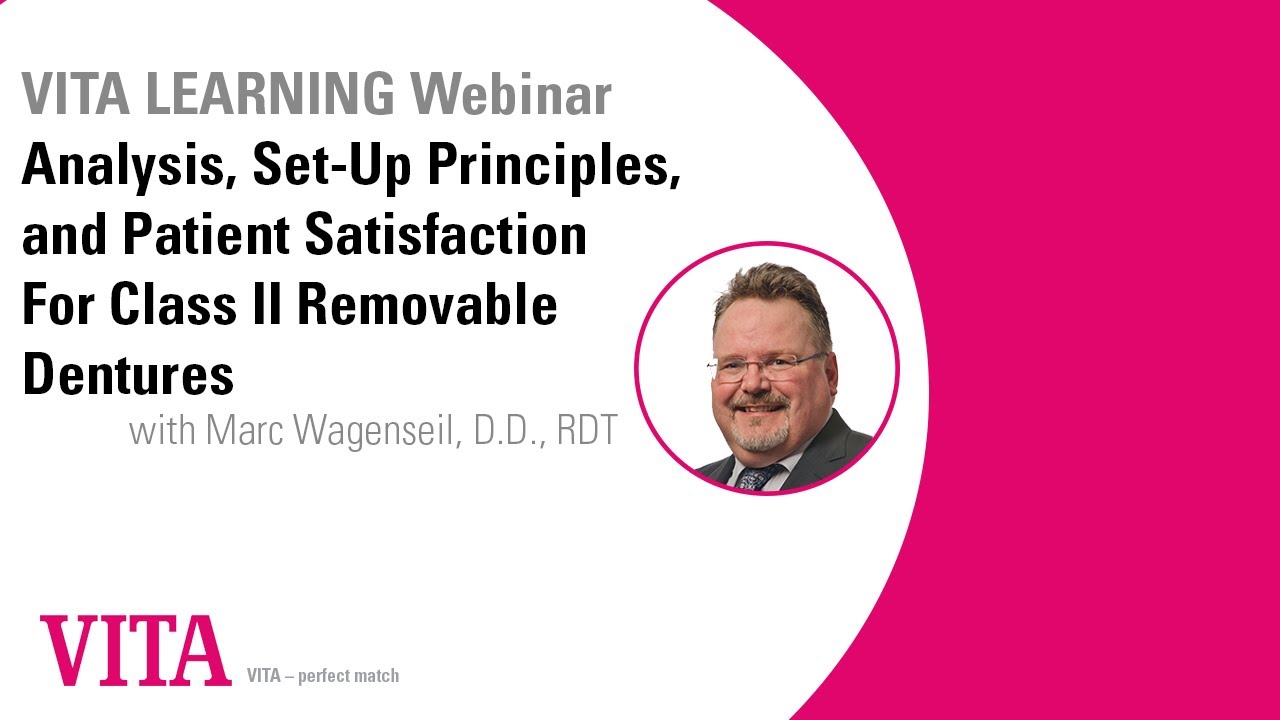 Analysis, Set-Up Principles, and Patient Satisfaction For Class II Removable Dentures