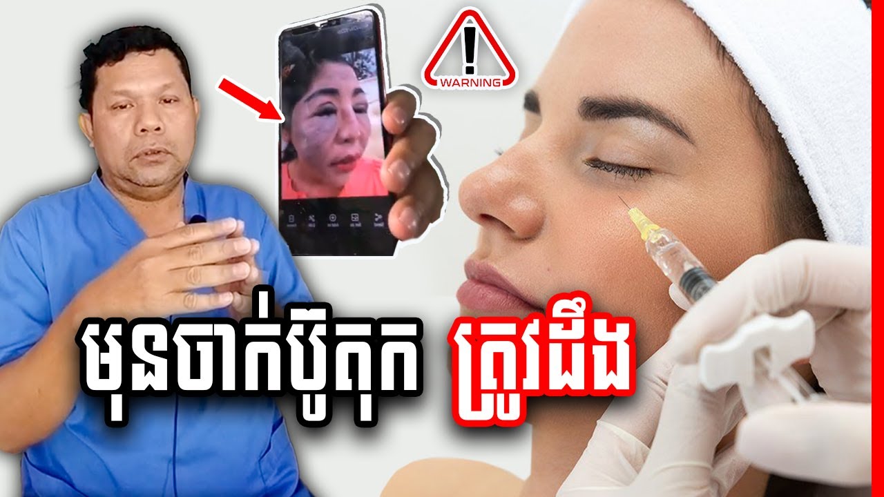ការចាក់ ប៊ូតុក នៅលើមុខ ប៉ះពាល់ដែរឬទេ? វេជ្ជ. ហែន ភារៈ , Botox injection