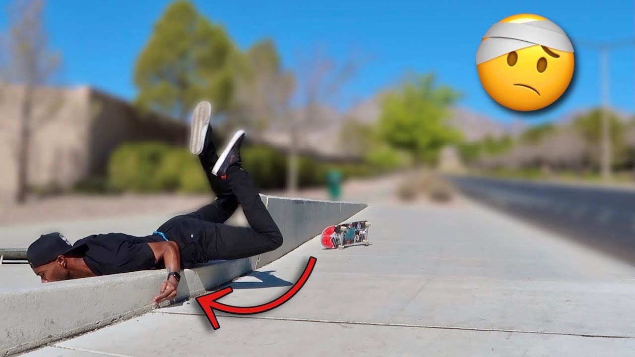 My Worst Skateboarding Fall