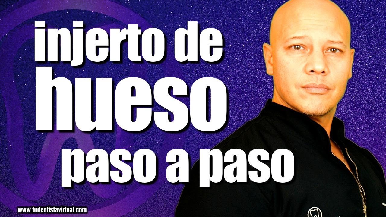 OTRA ALTERNATIVA A LOS TEMIDOS INJERTOS DE HUESO