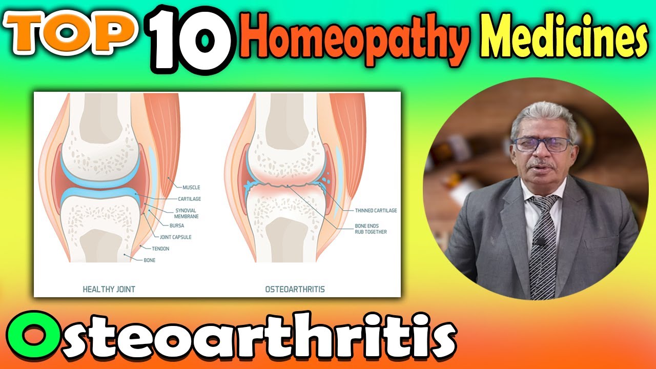 Osteoarthritis: Causes and #homeopathy medicines -- Dr P S Tiwari