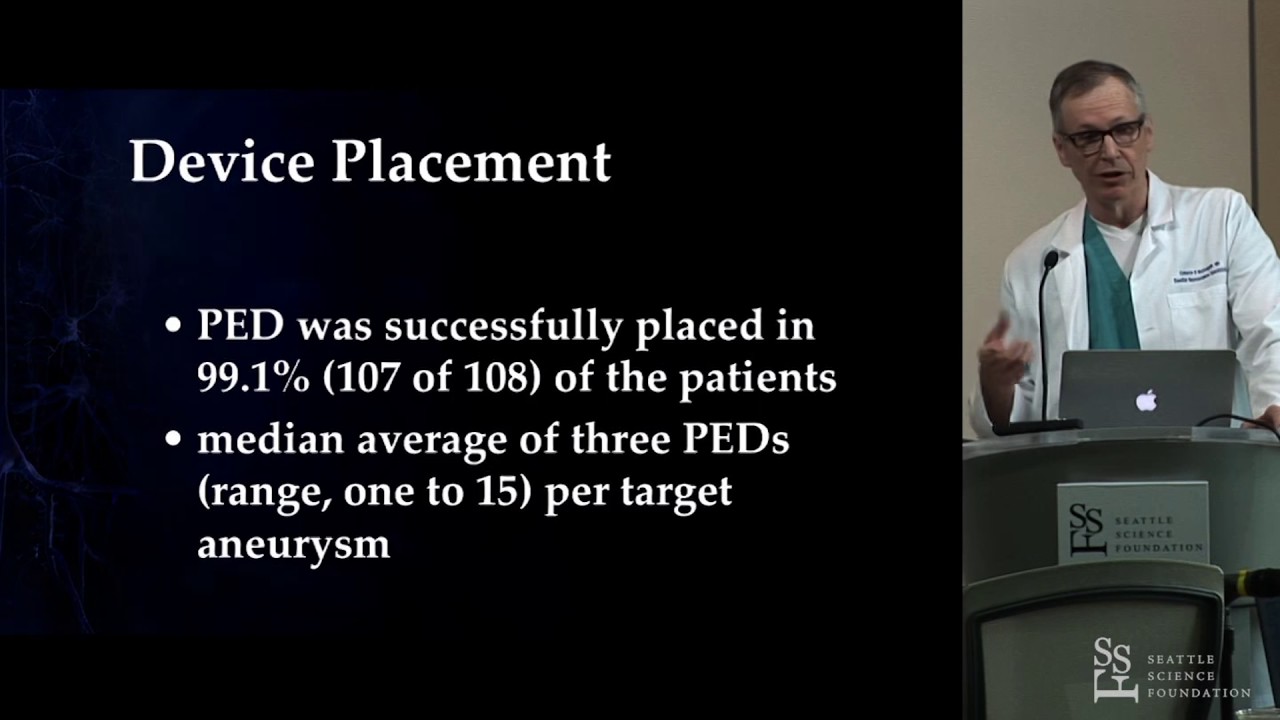 Flow Diversions for Intracranial Aneurysms: Current State of the Art - Cameron McDougall, MD