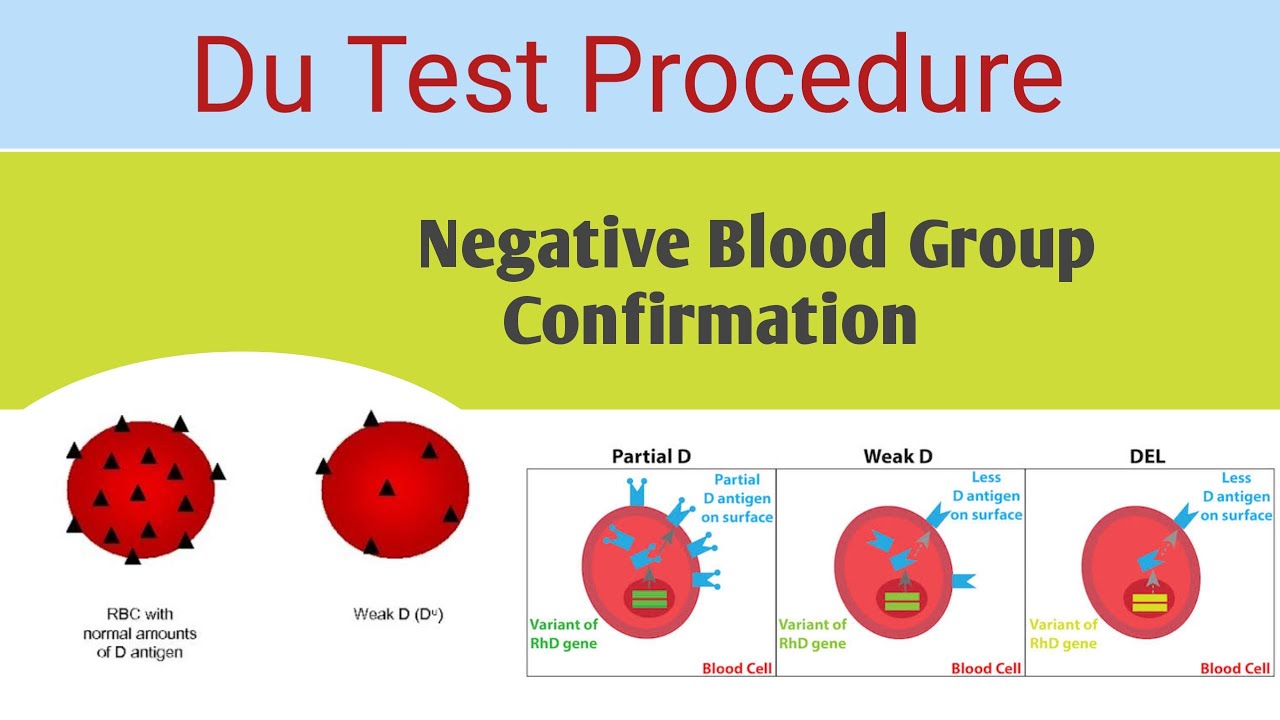 Du blood group | Du blood group procedure | Negative Blood Group Confirmation