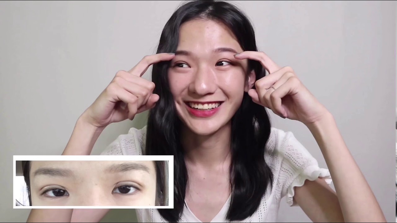 埋线双眼皮 Q&A 👁