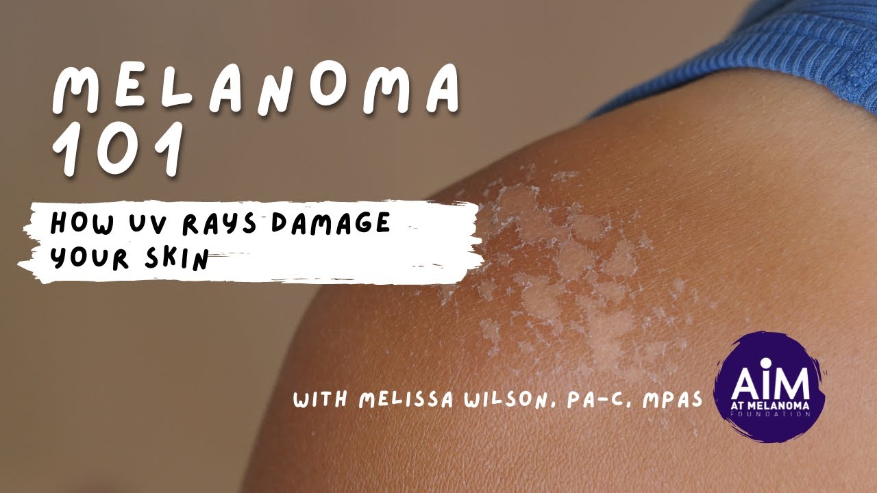 How UV Rays Damage Your Skin