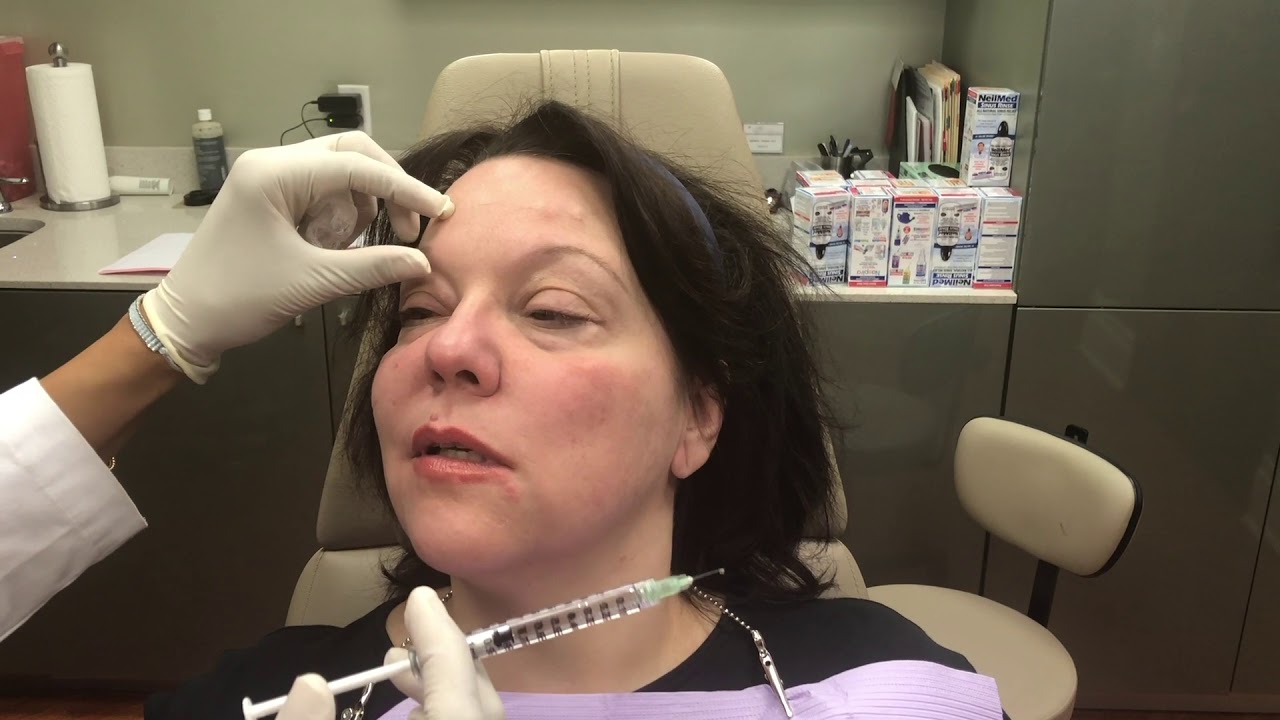Bells Palsy Patient in New Jersey Shares Her Testimonial