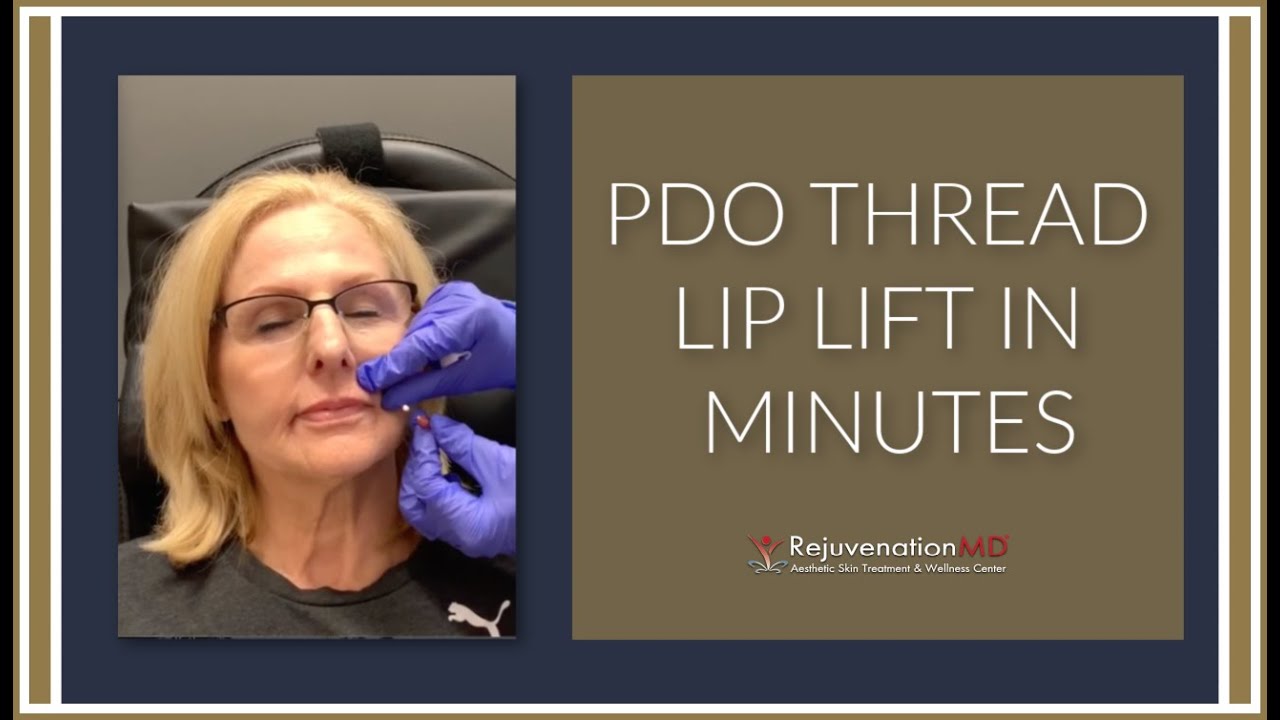 Why Do A PDO Lip Lift?