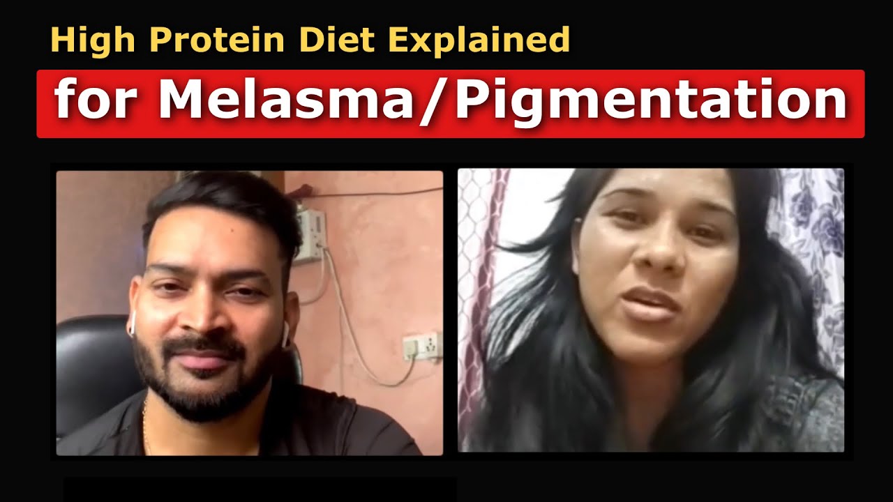 High Protein Diet Explained to My Subscriber for “Melasma/Pigmentation”