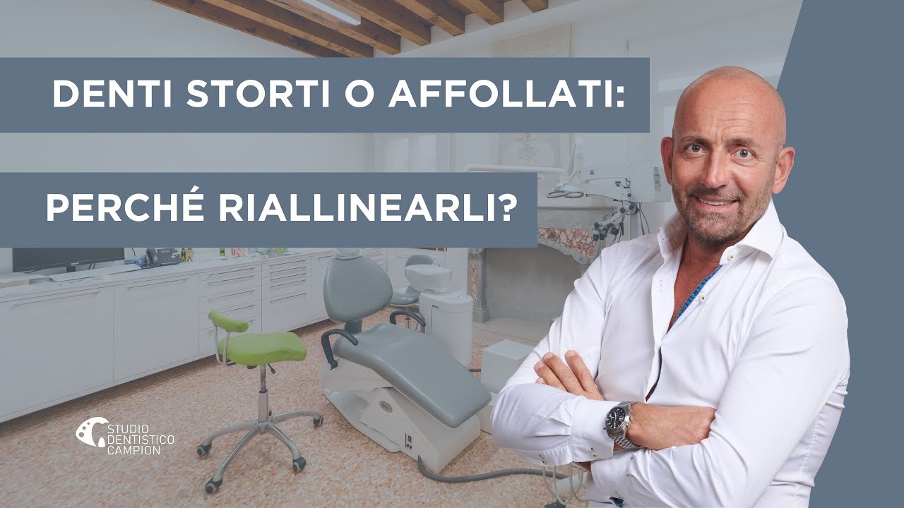 Denti storti o affollati: perch&eacute; riallinearli?