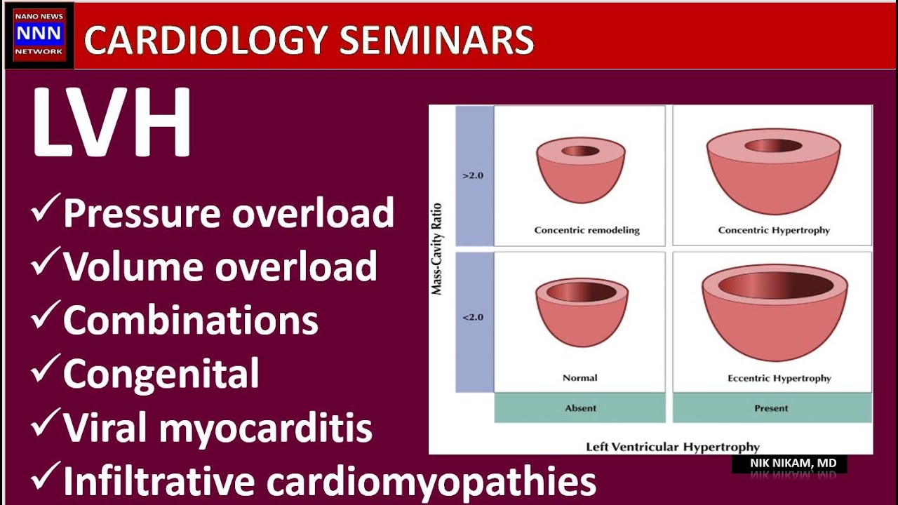 LVH | Concentric | Eccentric | Dilated | Infiltrative | Asymmetric Nik Nikam MD
