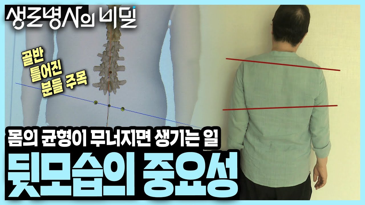 뒤태를 보면 건강이 보인다! 뒷 근육 부족으로 몸이 틀어지기 시작하면 생기는 일 I KBS 210807 방송