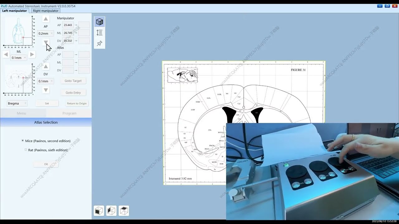 Automated stereotaxic instrument operation video