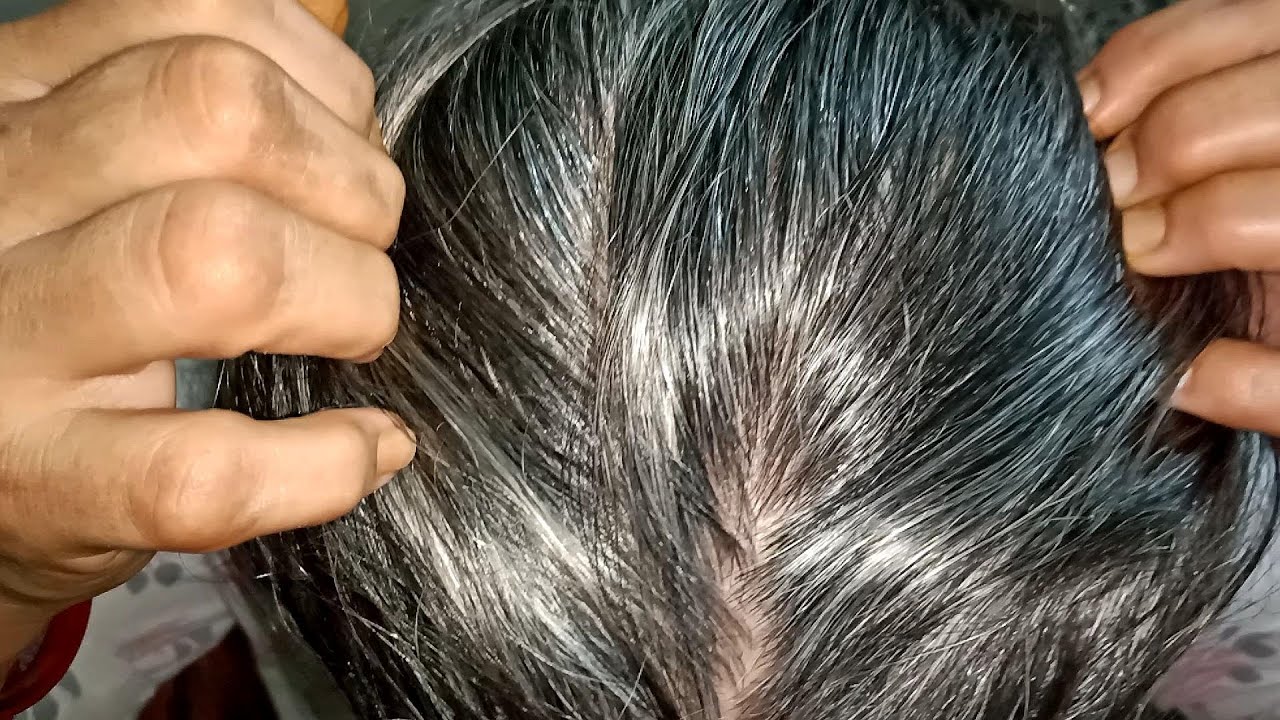 Ghar Par Banaye Shandar Amla Ka Tel | Hair Growth Ka Secret!