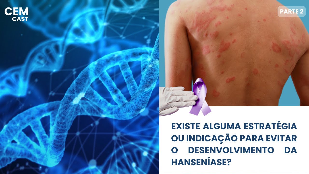 Hanseníase, Parte 2 - CEM CAST Episódio 91