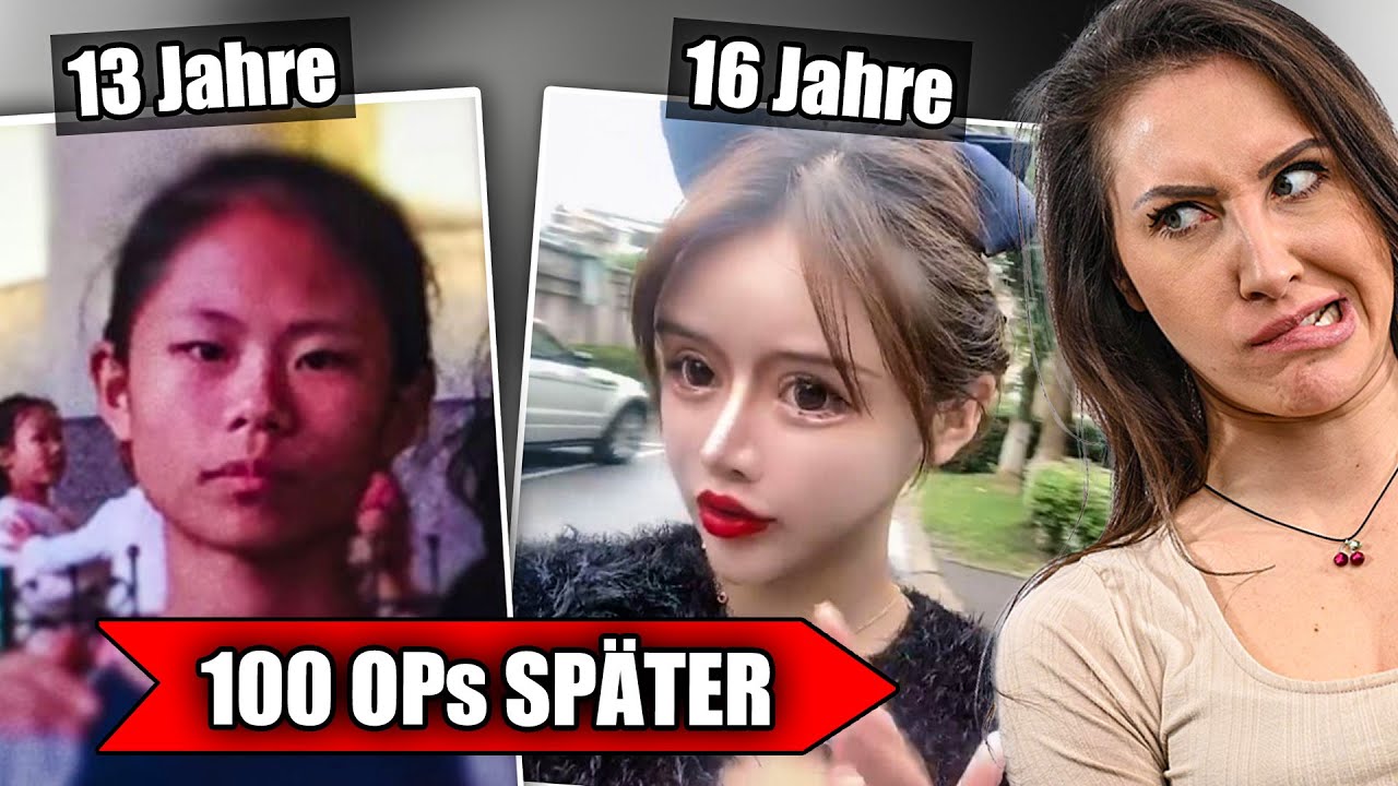 Diese 16 j&auml;hrige Influencerin hatte &Uuml;BER 100 SCH&Ouml;NHEITS-OPs! K&ouml;rperdysmorphe Influencer!