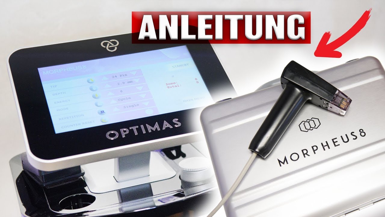 Morpheus8 Radiofrequenz Needling (Hochpreis-Behandlung) Erfahrungsbericht