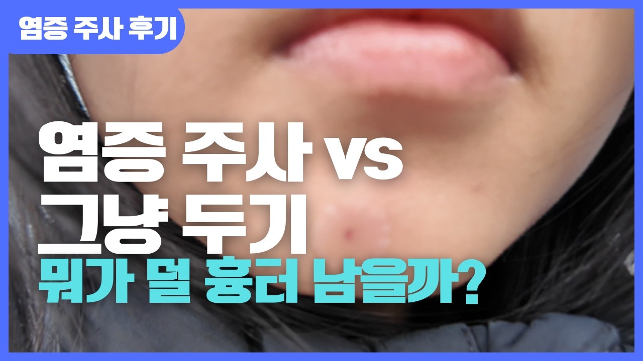 염증 주사 vs 그냥 두기, 뭐가 더 흉터 덜 남을까? 여드름 효과