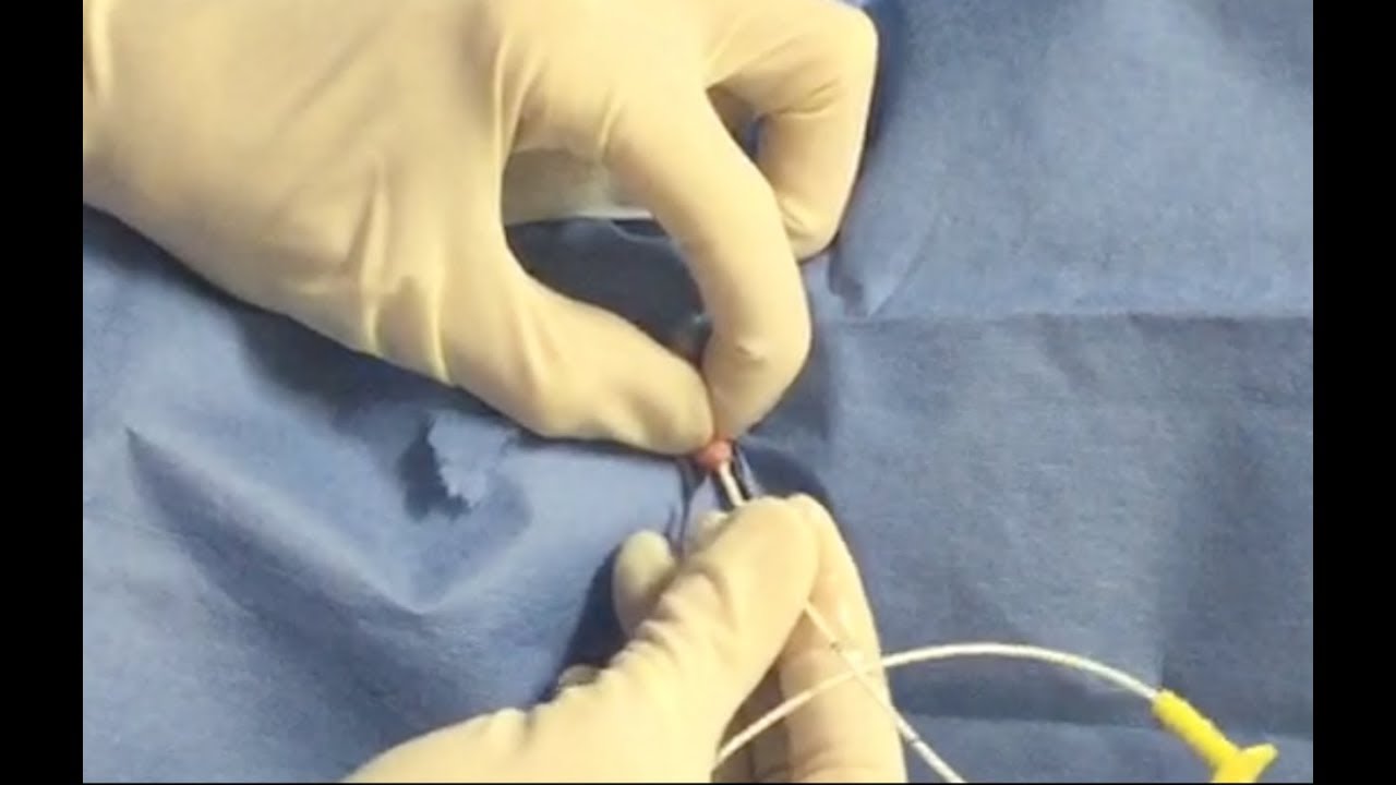 How to Perform Urethral Catheterization In A Blocked Cat│Veterinary Emergency Procedures