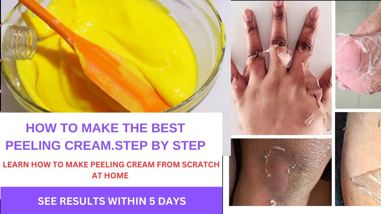 HOW TO MAKE DARK KNUCKLES PEELING CREAM #skincare #peelingcream  #beauty