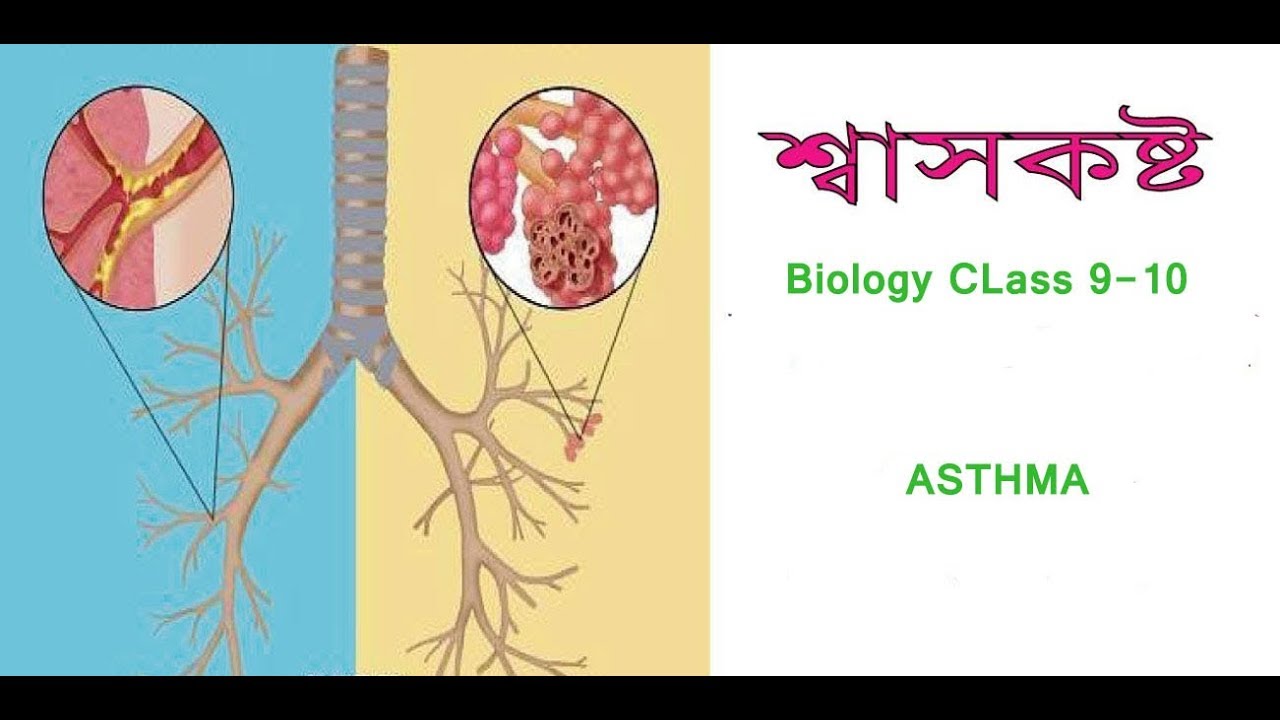 Online Class 9-10 | Biology | Chapter-  Asthma