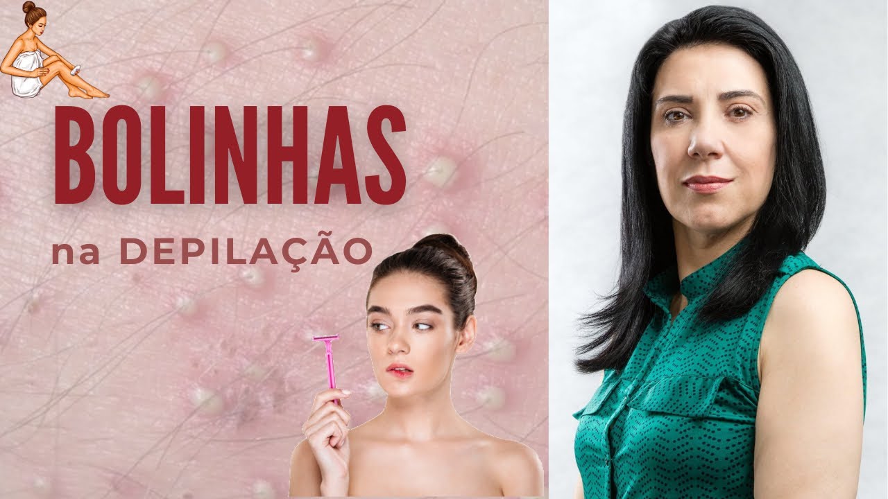 BOLINHAS  e Irritações na Pele depois da DEPILAÇÃO !