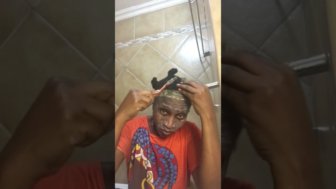 I Combined Minoxidil & Tretinoin | Here's What Happened