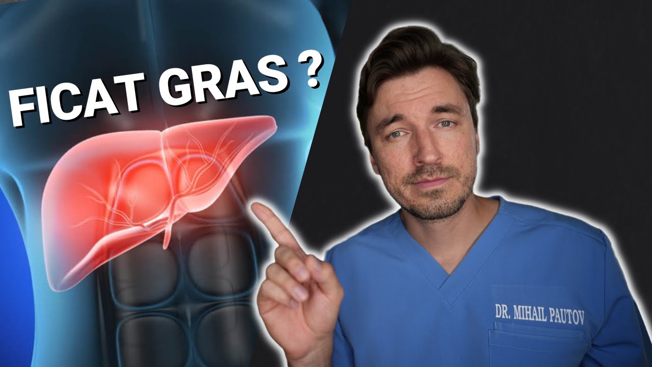 7 REGULI pentru un FICAT GRAS (din experiența unui chirurg)