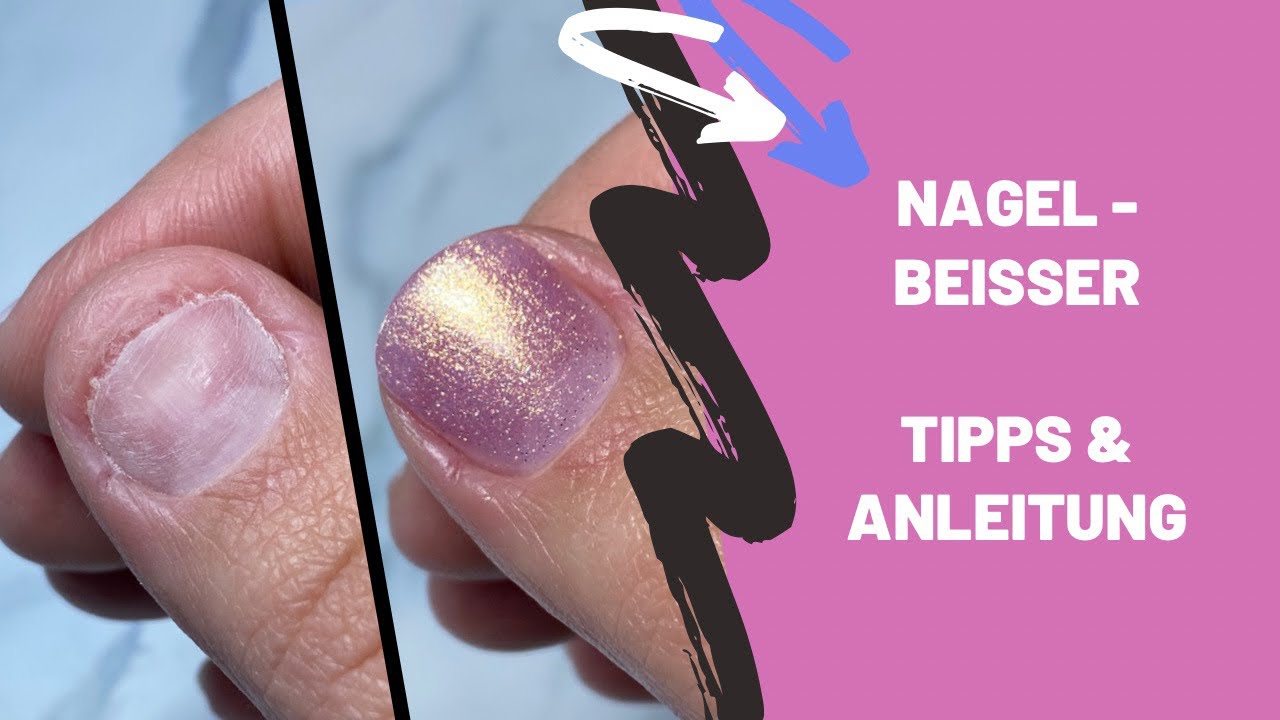 Nagelbeißer | Tipps & Anwendung mit Acrylgel