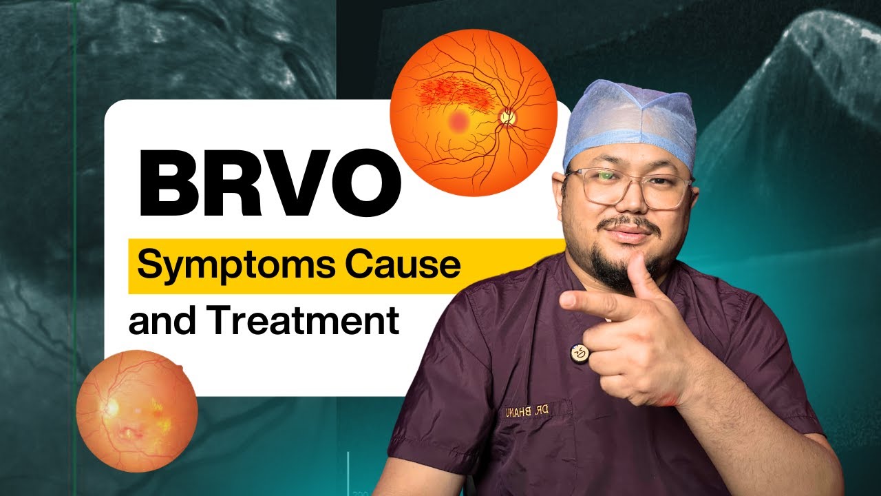 BRVO (पर्दे की नस फट जाना ) | लक्षण, कारण और इलाज | 