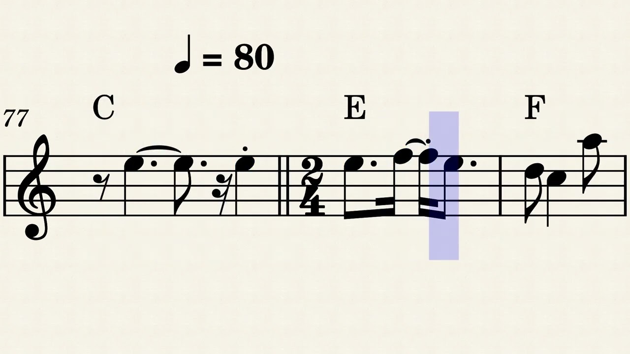 INMORTAL  La Oreja De Van Gogh